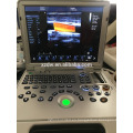 DW-C60plus portátil 3D 4D color doppler máquina de ultrasonido con aprobación CE